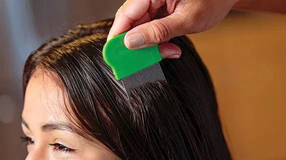 Electric Lice Remover: Quick, Safe, and Effective Solution for Lice Removal.