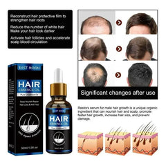 Hair Growth Oil Effective Rapid Repair Fast Baldness Hair Postpartum Hair Loss Follicles Hereditary Hair Loss Hair Care Solution.